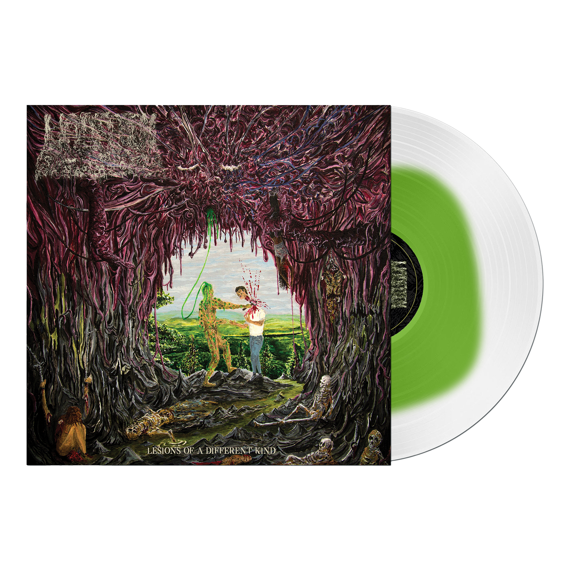Lesions of a Different Kind Green in Clear Vinyl *Limited to 100 Copies*